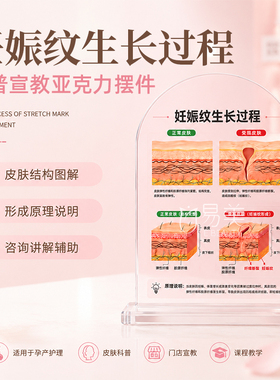 妊娠纹生长过程亚克力摆台孕产皮肤科普宣教展示护理机构讲解教具