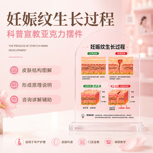 妊娠纹生长过程亚克力摆台孕产皮肤科普宣教展示护理机构讲解教具