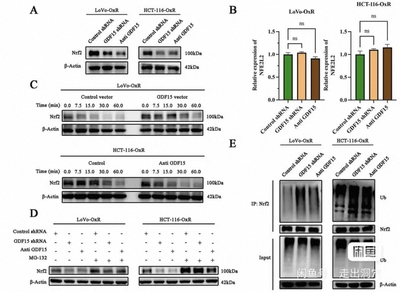 个人WB条带趋势定制实验/western blot/蛋白免疫印迹测试免疫印迹