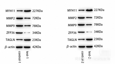 个人Wb条带/westernblot/趋势定制/实验/科研蛋白检测/跑条带
