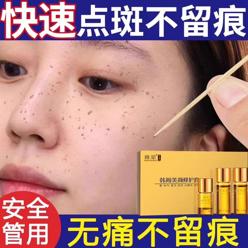 祛斑点斑专用药水精华液分解黑色素雀斑老年斑不留疤正品强力去除