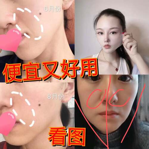 法令纹 小脸的天敌  晚上睡前一贴 第二天决对给你惊喜青春永葆贴
