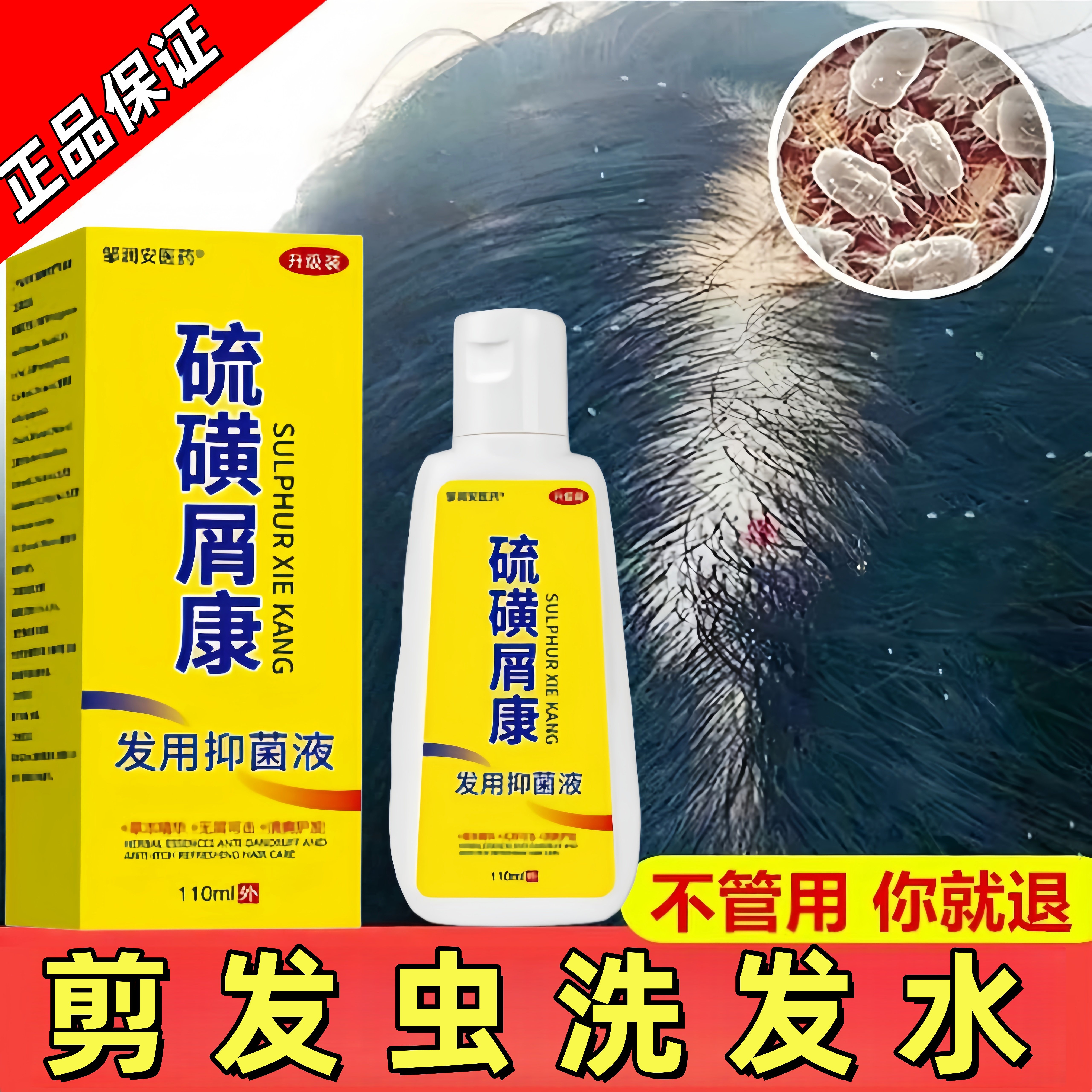 去剪发虫洗发水头屑头成人儿童痒除螨卷发虫吃发虫白点硫磺洗发露