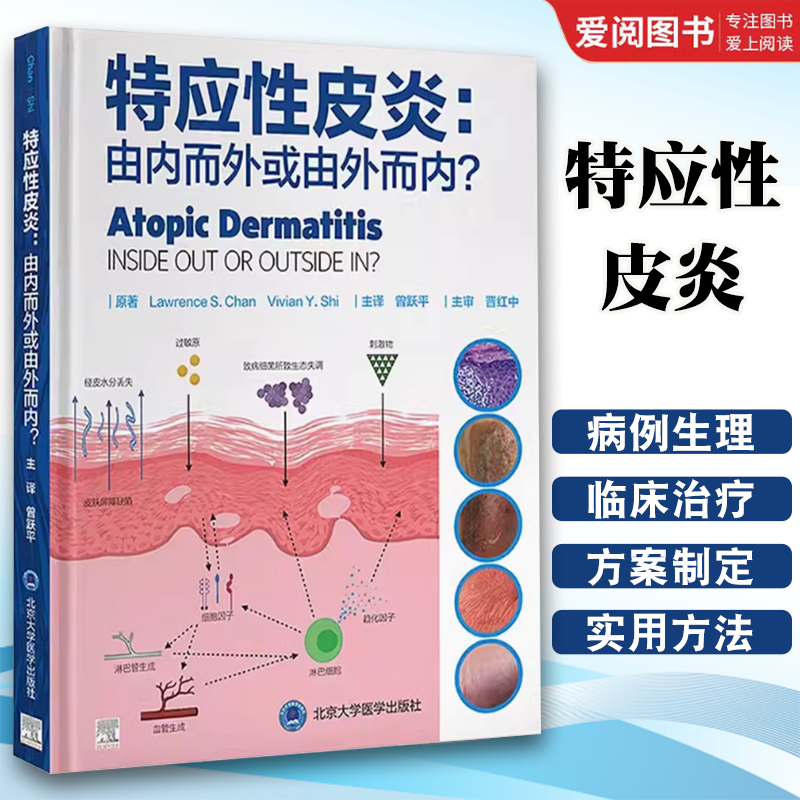 正版特应性皮炎 由内而外或由外而内 北京大学医学出版社 病理生理学分析 临床治疗方案制订实用方法 教程教材书籍