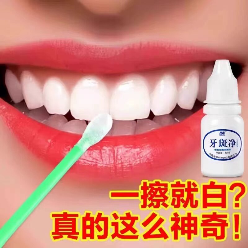 洁牙粉牙齿美白速效去黄牙黑斑去烟渍洗牙污垢茶渍牙菌斑祛除神器