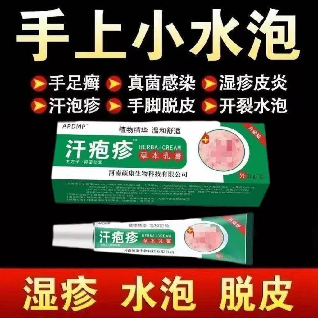 手上起小水泡汗泡疱止痒抑菌中药鹅掌风真菌感染手气湿痒疹专用膏