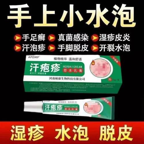 手上起小水泡汗泡疱止痒抑菌中药鹅掌风真菌感染手气湿痒疹专用膏