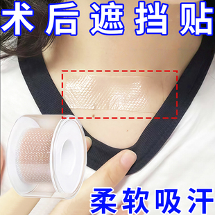 甲状腺术后遮挡贴遮挡伤疤遮挡伤口可重复使用水凝贴合出门遮挡贴