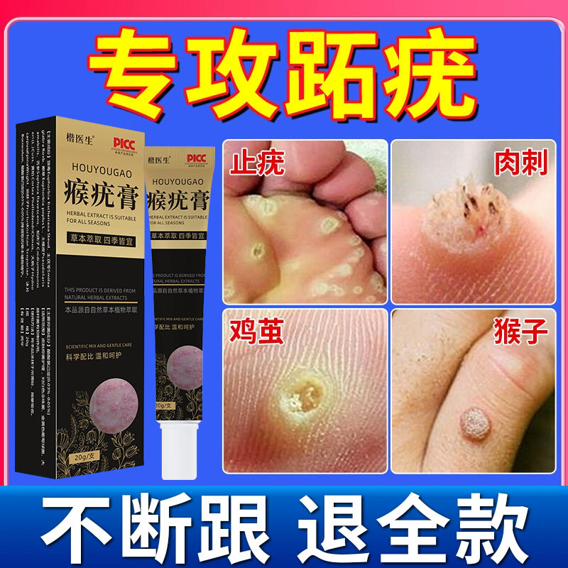 跖疣膏专用膏去寻常疣根病毒拓趾足部根立净疣去除脚底蚩尤膏