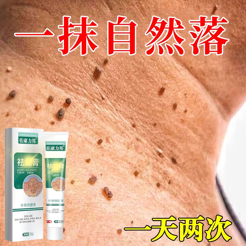 扁平疣去除软膏一抹灵去疣尤瘊用专根斩草除根祛疣小肉粒药膏医用