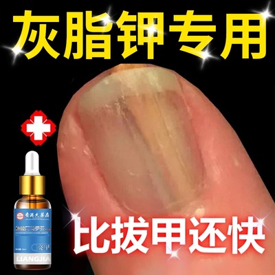 阿莫罗正品芳茶剂趾甲坏甲空甲烂灰脂空甲增厚发黄快速修复抑菌