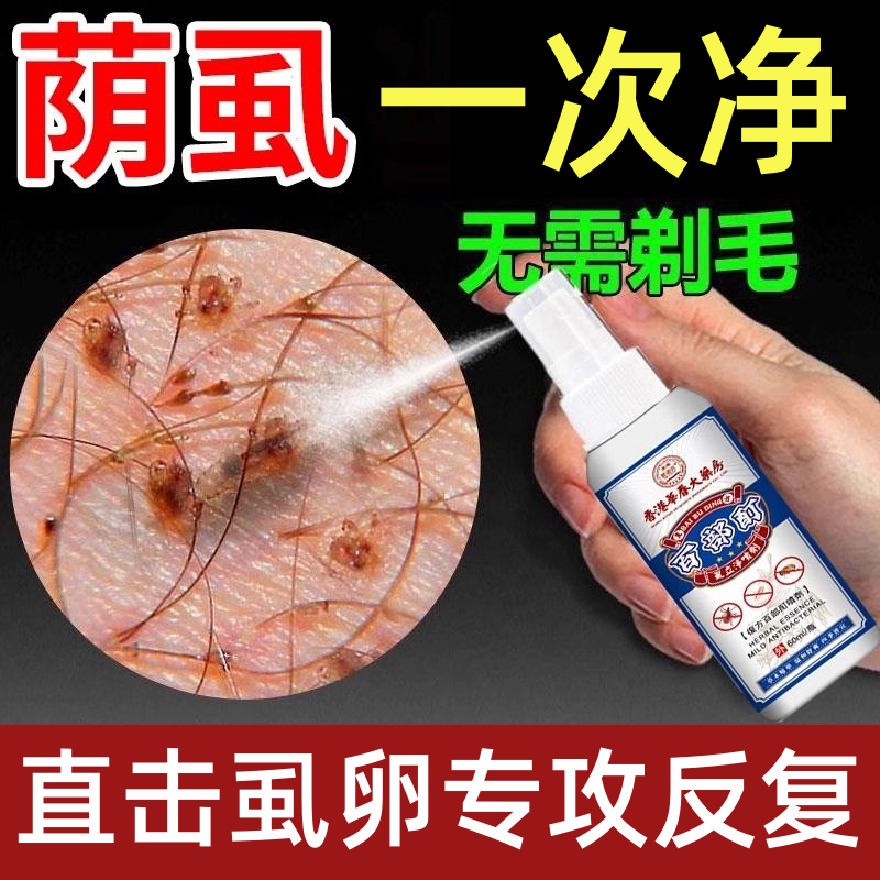 香港百部酊灭阴虱头虱药男女士私处虱子克星成人一扫光虱立净喷剂