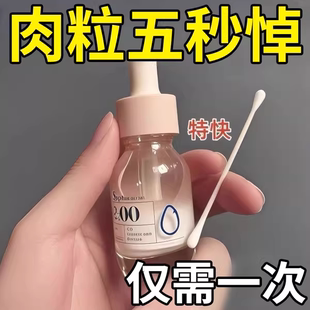扁平疣去除软膏一抹灵去疣尤瘊用专根斩草除根祛疣小肉粒药膏医用