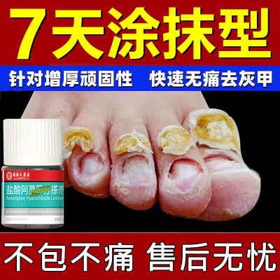 灰指甲脱甲膏专用抑菌液甲沟炎灰趾指甲快速脱甲精油脚指甲软化剂