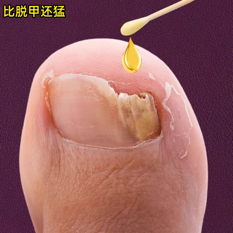 【屈巨氏热卖】滴一滴 不包不修 不伤好 钾 买2送1 买3送2！！