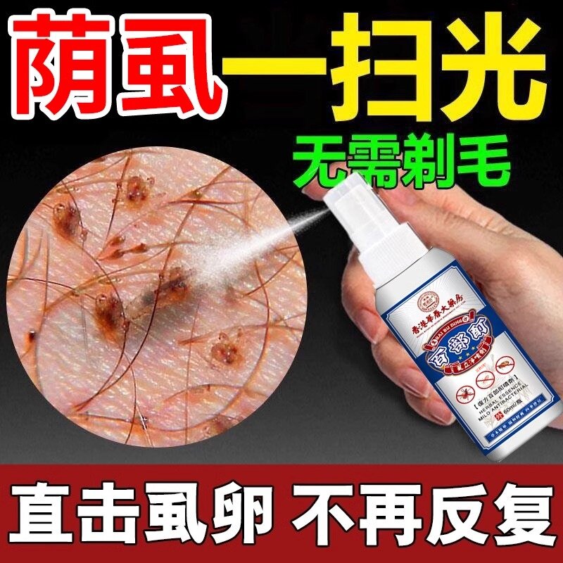 男士私处阴虱专用药虫卵双杀一扫光官方正品旗舰店复方百部酊喷剂