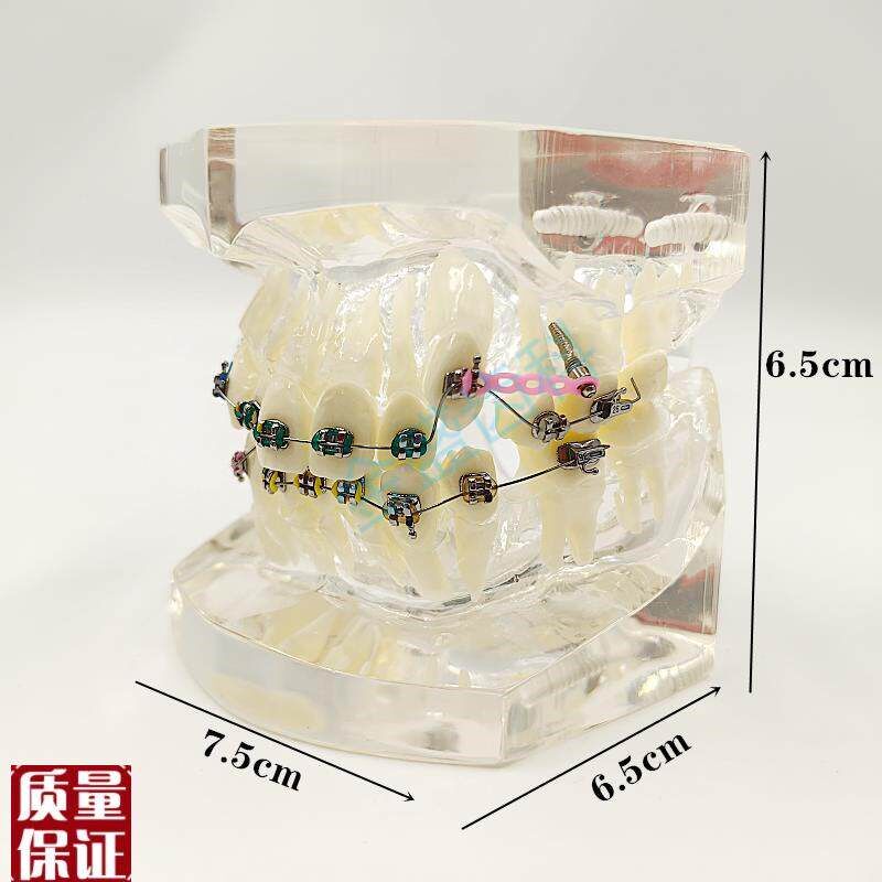 速发模型b正畸结紮丝托槽口腔教学模型牙齿错颌矫正展示透明牙