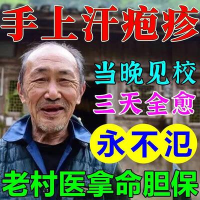 现货速发汗泡疱疹药膏手上起小水泡汗状疱疹止痒软膏乾裂脱皮