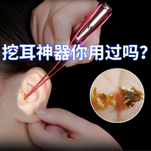 挖耳勺发光儿童掏耳朵神器宝宝掏耳勺带灯镊子掏耳朵采耳工具套装