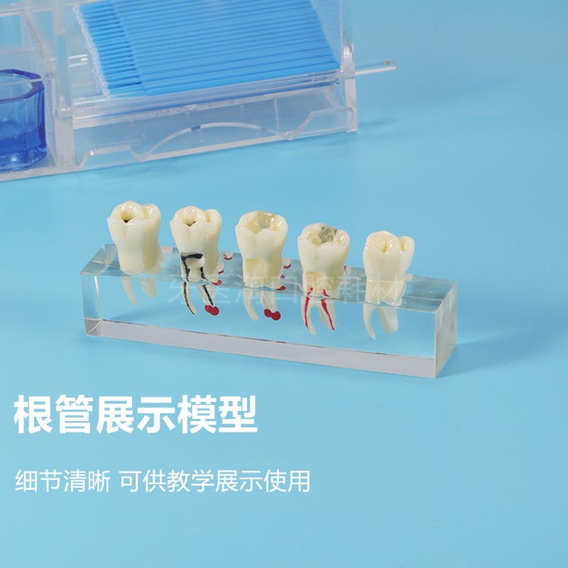 口腔教学模型根管治疗