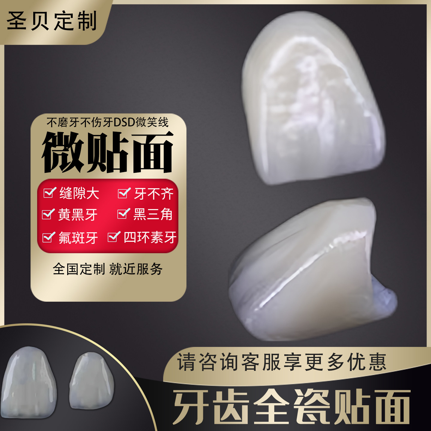 牙齿局部微贴片微贴面门牙贴牙贴全瓷贴面遮牙缝隙全瓷牙贴片