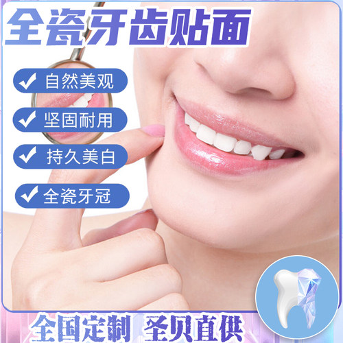 泽康全瓷牙齿贴面全瓷瓷大师马里兰桥贴片进口全国定制微贴片
