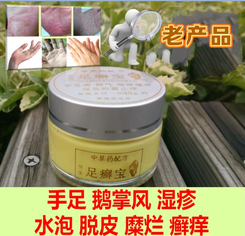 脚脱皮脚水泡干燥手脱皮手气脚气手部脚癣手足藓鹅掌风止痒膏
