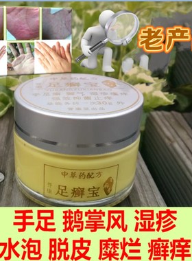 AK手足癣宝手足癣宝套装