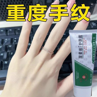 【告别主妇手】玻尿酸护手霜手纹提亮美手精华霜纤长手指变细去皱