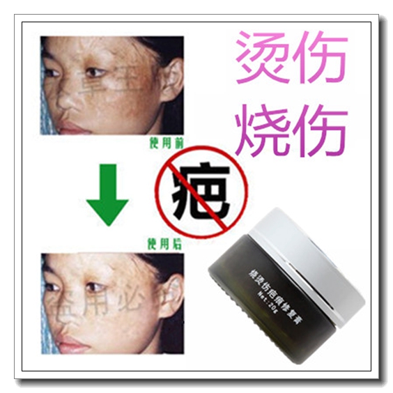 去除嘴唇部黑色素沉着淡化修复刀伤口皮肤贴遮疤痕灵
