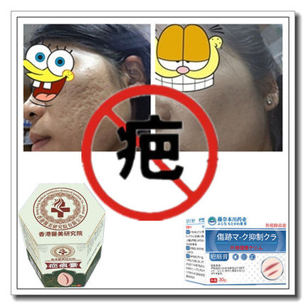 灵疙瘩修复增生性凸疤手术剖腹产伤疤痕印纹身缝针抓伤色素沉着疤
