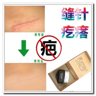 去脸部刀疤下巴黑色素印祛伤疤痕灵止痒软化乳膏修复手术增生性贴