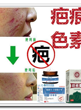 消除疙瘩体质祛增生性凸疤手术产后去开刀割伤巴痕灵缝针精油斑印