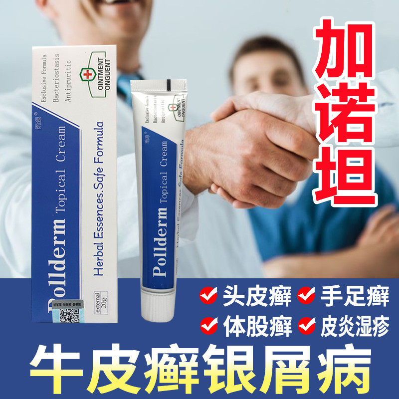 【美国加诺坦】牛皮银屑病无激素手足头皮肤外用牛皮藓全身抑菌