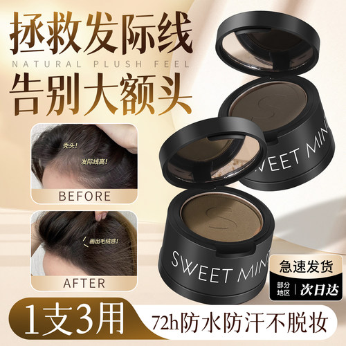 {明星同款}央ma力荐发际线粉