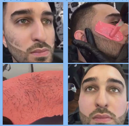 Отрывной воск для депиляции подходит для мужчин и женщин для интимного использования, удаление волос