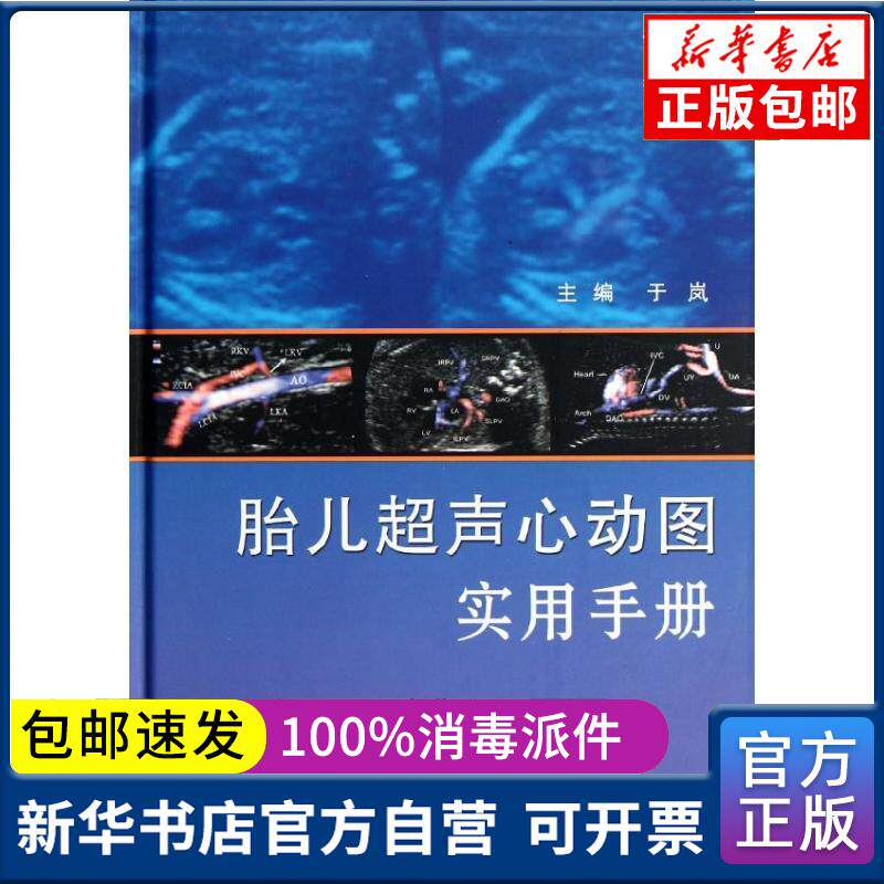 正版包邮 胎儿超声心动图实用手册于岚人民卫生出版社9787117158336妇
