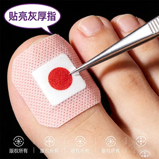 灰手增厚正品 专用灰指贴发黄粉脚手指甲专 香港断货王 拍一发二