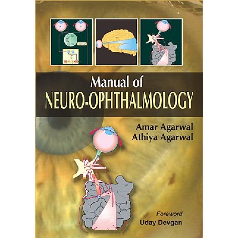 预订 manual of neuro-ophthalmology [9780071632317]