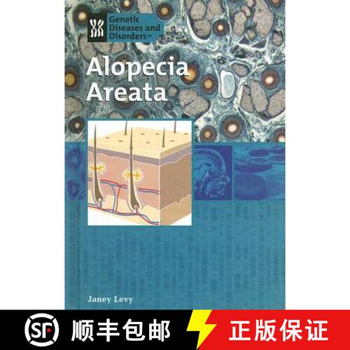 【3-4周达】Alopecia Areata [9781404206939]
