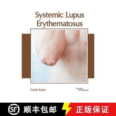 【3-4周达】Systemic Lupus Erythematosus [9781632418685]