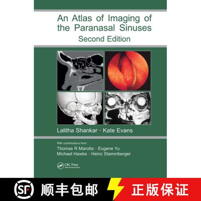 【3-4周达】Atlas of Imaging of the Paranasal Sinuses, Second Edition [9781841844480]