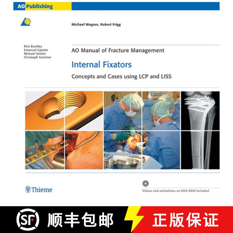 【3-4周达】AO Manual of Fracture Management - Internal Fixators: Concepts and Cases Using LCP/LISS [9783131435514]