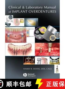 【3-4周达】Clinical And Laboratory Manual Of Implant Overdentures [Wiley牙科医学] [9780813808819]