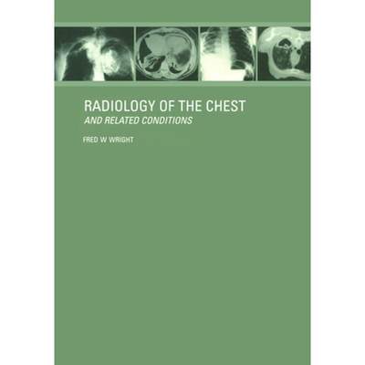 【4周达】Radiology of the Chest and Related Conditions: Together with an extensive illustrative colle... [9781138464933]