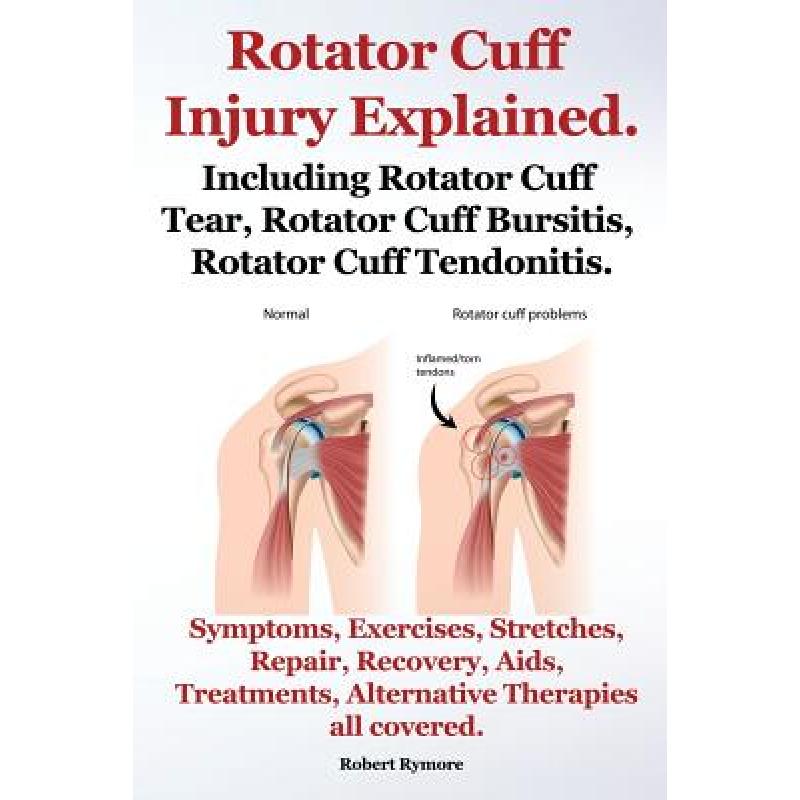 【4周达】Rotator Cuff Injury Explained. Including Rotator Cuff Tear, Rotator Cuff Bursitis, Rotator C... [9781909151710] 书籍/杂志/报纸 原版其它 原图主图