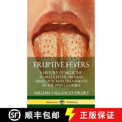 【3-4周达】精装 Eruptive Fevers: A History of Medicine - Scarlet Fever, Measles, Small-Pox and Treatm... [9780359733149]