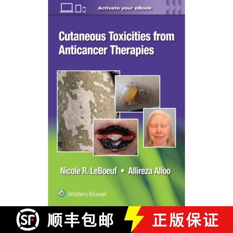 【3-4周达】Cutaneous Toxicities from Anticancer Therapies [9781975157890]