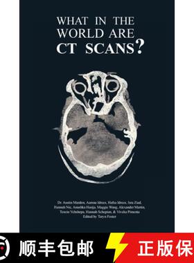 【3-4周达】What in the World are CT Scans? [9781773692265]