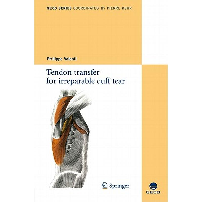 【4周达】Tendon Transfer for Irreparable Cuff Tear [9782817800486]